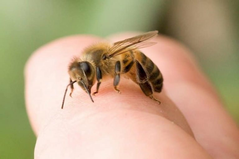 Bee-Sting-Remedies2-768x512
